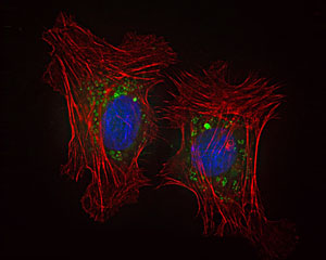 Upon entering cells, nanoparticles begin to biodegrade, shedding their polyethylene glycol coat (green) and releasing their drug payload. Here the cell skeleton is shown in red, the cell nucleus in blue. The green color inside the cell demonstrates that the nanoparticles entered the cell. Al entrar en las células, las nanopartículas empiezan a degradarse, despojando su capa de polietilenglicol (verde) y liberando su carga de fármacos. Aquí, el esqueleto de la célula se muestra en rojo, y el núcleo de la célula en azul. El color verde dentro de la célula demuestra que las nanopartículas entraron en la célula.