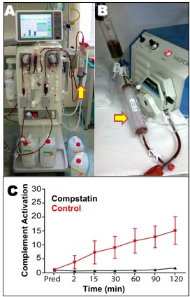 El equipo de hemodiálisis utilizado en la clínica (A) contiene los mismos filtros que el modelo simplificado ex vivo (B) que Lambris utilizó para evaluar la activación del complemento y la inhibición en condiciones de laboratorio. (C) La circulación de la sangre a través de los filtros durante 2 horas aumenta la activación de los componentes del complemento (rojo, de control), pero añadiendo el inhibidor del complemento, compstatin, disminuye la activación del complemento.