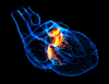 This is an image of a translucent heart