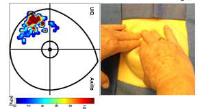 colors on left measure amount of pressure exerted during exam on right.
