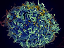 This is a microscopic image of an immune cell being infected by the AIDS virus.