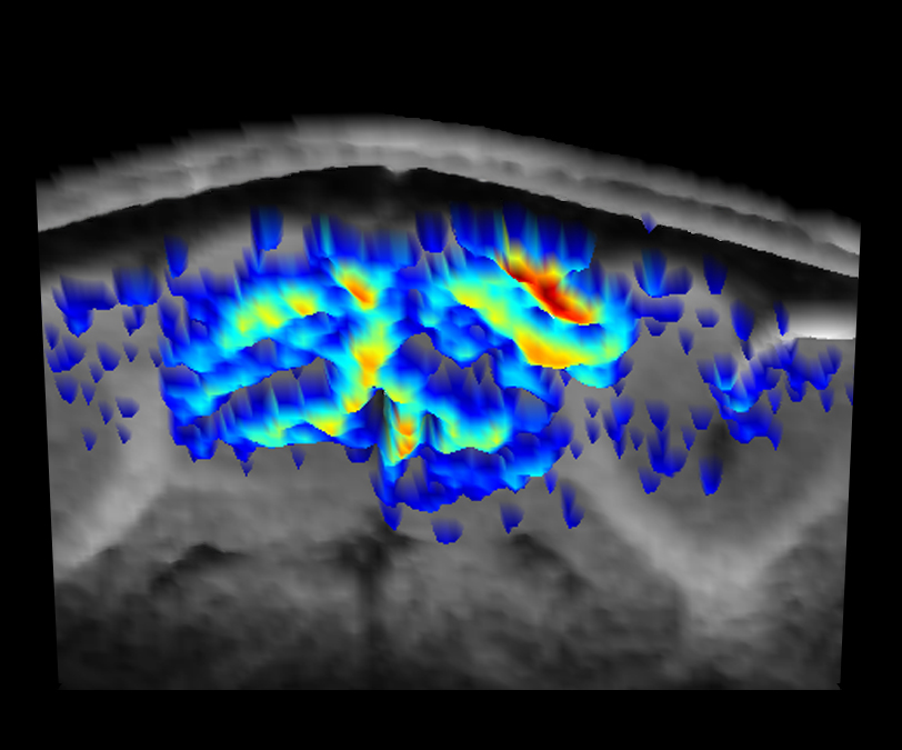 Functional magnetic resonance image (fMRI) of a brain Functional magnetic resonance image (fMRI) of a brain