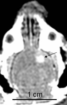 Los investigadores están usando ultrasonido enfocado a alterar (flecha) la barrera hematoencefálica de manera local, como se muestra en esta imagen de resonancia magnética mejorada por contraste del cerebro de una rata.
