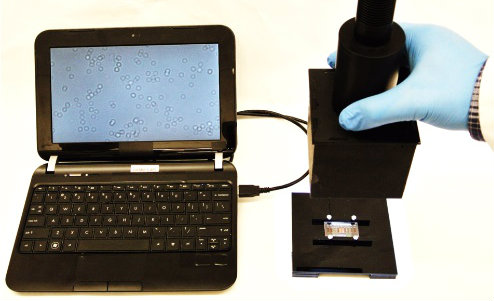 Hand held lensless device with attached laptop with image on screen