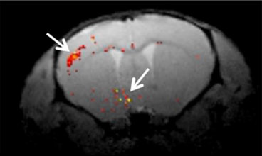 Mouse brain MRI showing orange dots of gene expression