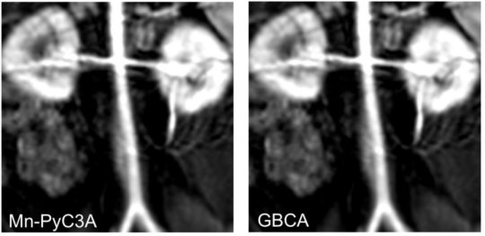 MRI scan of baboon abdomen