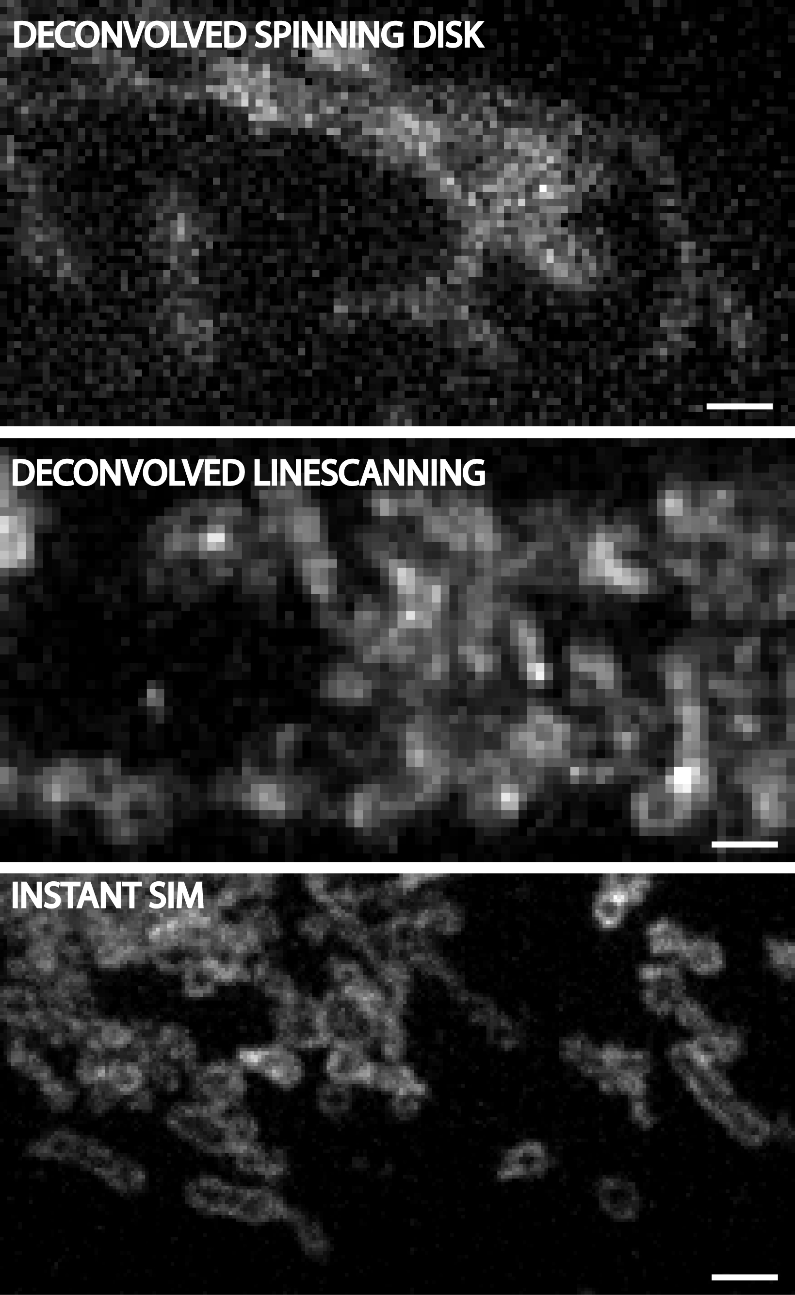 Three images showing differences in resolution between deconvolved spinning disk, deconvolved linescanning, and instant SIM.