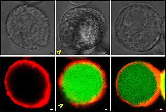 Campo brillante (arriba) y fluorescencia/confocal (abajo) microscopía de células cancerosas de próstata antes de (izquierda), inmediatamente después de (centro), y mucho tiempo después de (derecha) ser expuestas al ultrasonido. Los huecos en las membranas celulares están marcados con flechas. Cortesía de imagen de Robyn Schlicher.