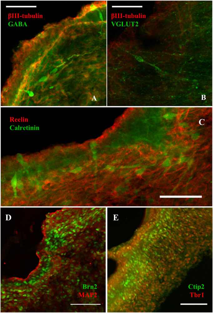 Blue, red and green image of the vascular network formation within neural constructs.