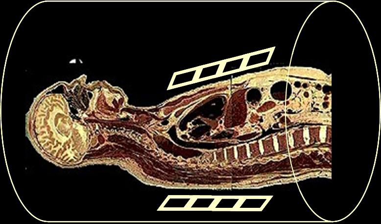 MRI image of the upper body and head of a person