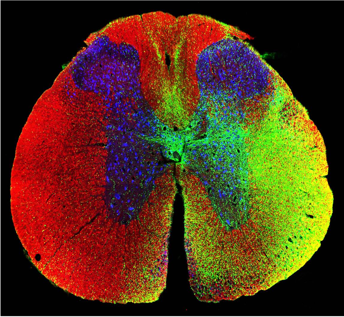 Cross section through treated rat spinal cord showing growth of human neurons into rat white and gray matter.