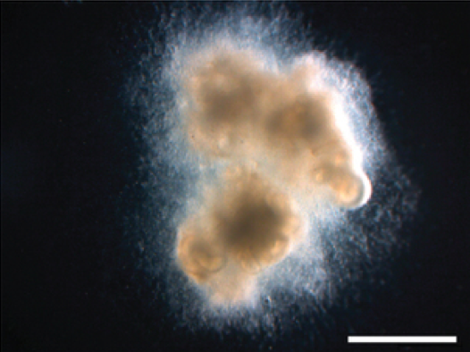 Image of a fuzzy white clump of intestinal tissue.