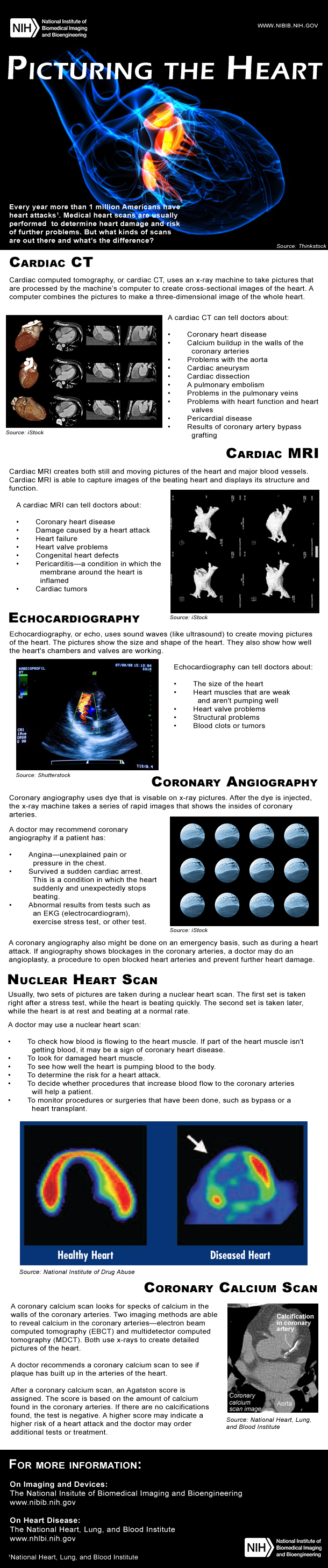 Image graphic with images and explanations of cardiac CT, cardiac MRI, echocardiography, coronary angiography, nuclear heart scan, and coronary calcium scan