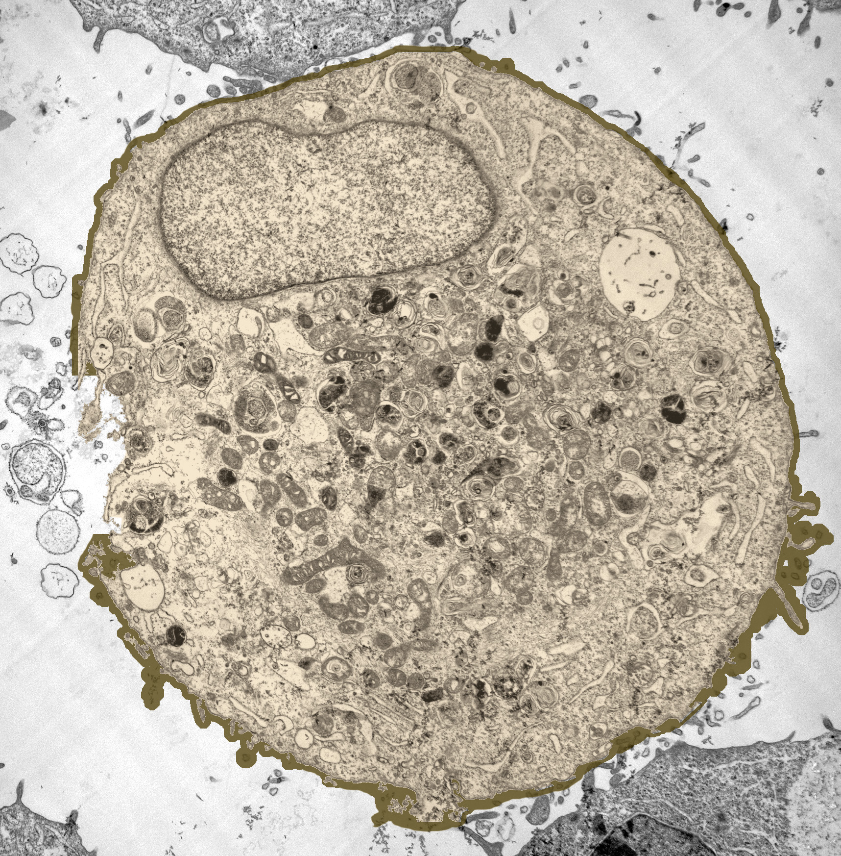 Micrografía de transmisión electrónica que muestra una célula cancerosa de próstata, inmediatamente después de haber sido expuesta al ultrasonido. El color de la imagen se ha mejorado para mostrar el sitio donde fue extraída la membrana celular. Cortesía de imagen de Robyn Schlicher, Robert Apkarian, y Mark Baran.