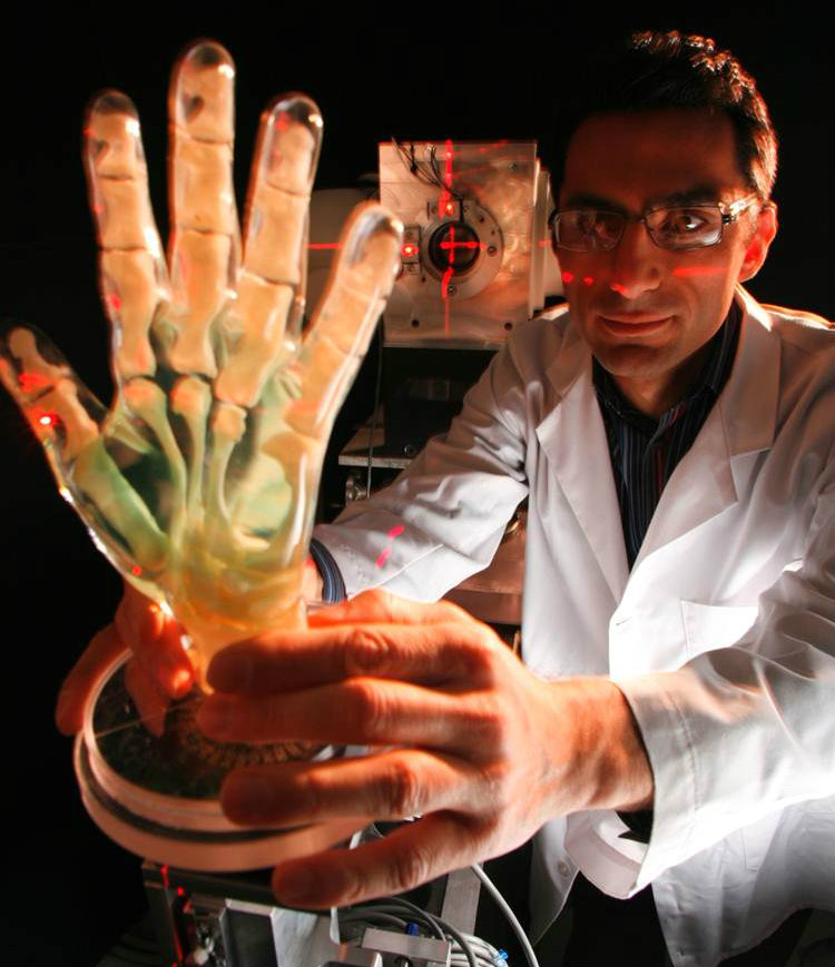Doctor using a laser to measure movement of a model of the human hand.