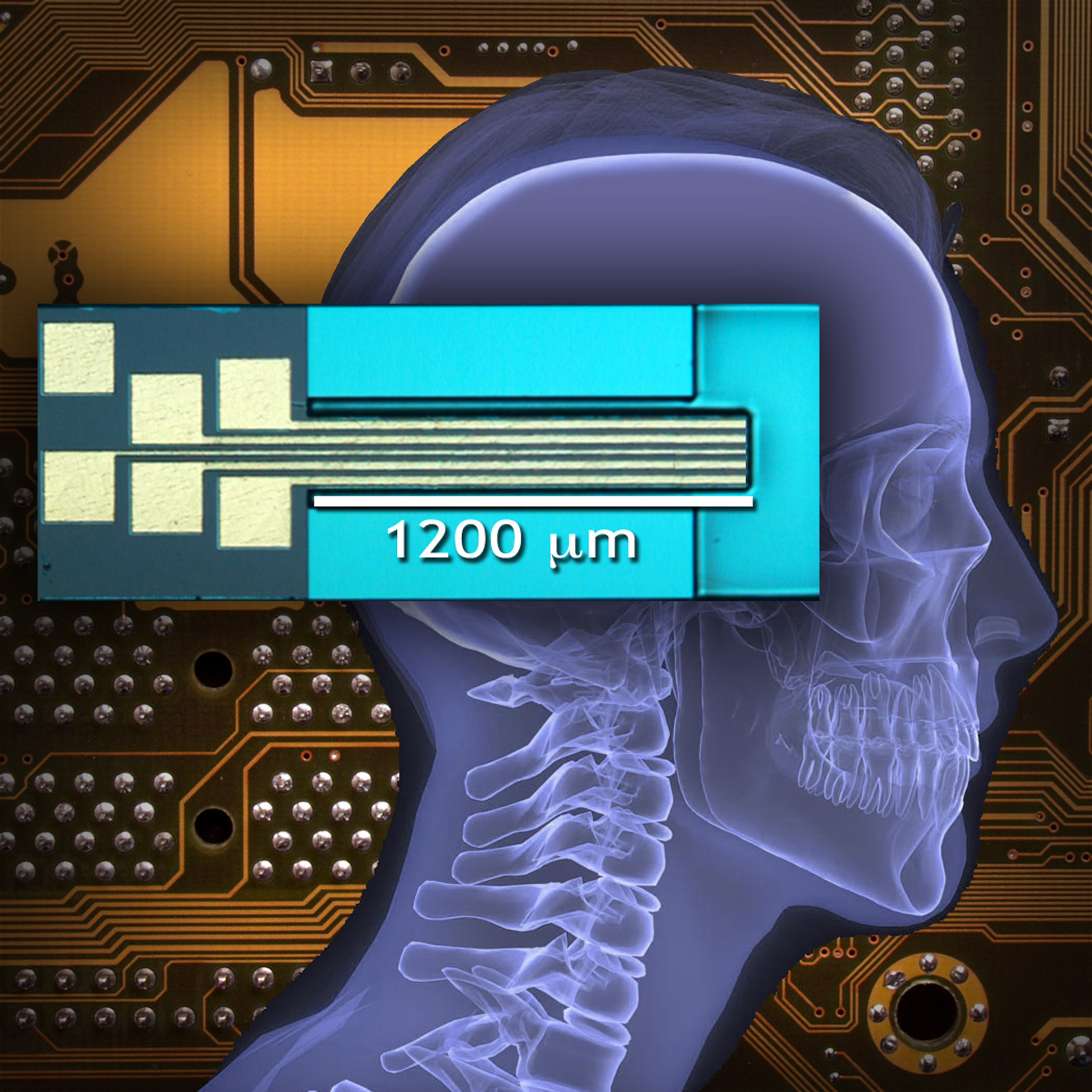 El clamp neural activo de las raíces medulares puede mejorar el movimiento en personas con lesiones de la médula espinal o que se estén recuperando de un infarto cerebral. Los contactos de la zona de soldadura de hilos oro para 5 electrodos puede observarse en este clamp. Estos pueden proporcionar estimulación nerviosa o retroalimentación para refinar el movimiento. Cortesía: Ranu Jung, Instituto de Biodiseño (Biodesign Institute), ASU