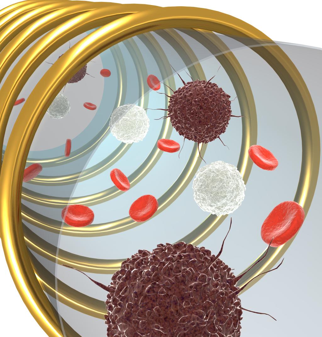 Células cancerosas en muestras iniciales (sin procesar), como sangre y biopsias, son etiquetadas con nanopartículas magnéticas que se unen a biomarcadores específicos de cáncer en la superficie de la célula. Un sensor miniaturizado detecta entonces las células etiquetadas magnéticamente a través de la RMN. Crédito: Hakho Lee.