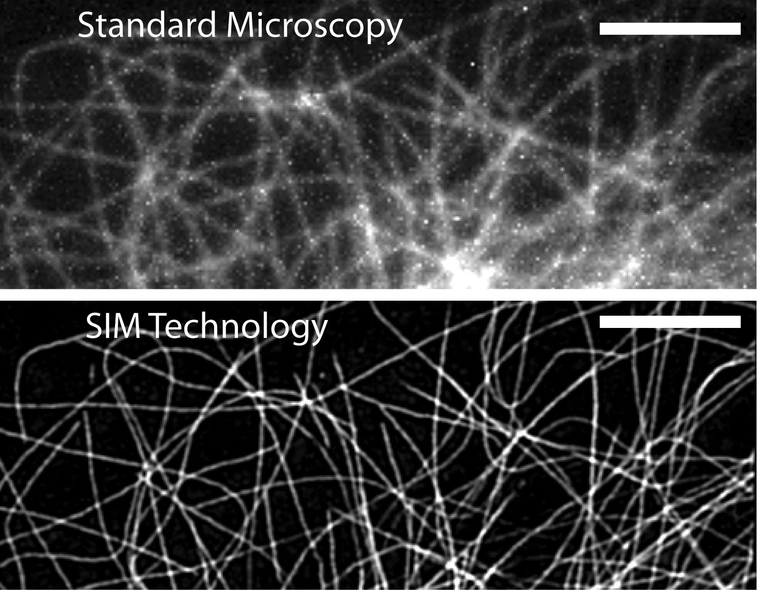Two images comparing the resolution, one very fuzzy, the other much clearer