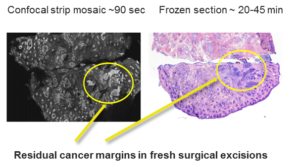 This is an image that shows residual cancer margins in fresh surgical excisions