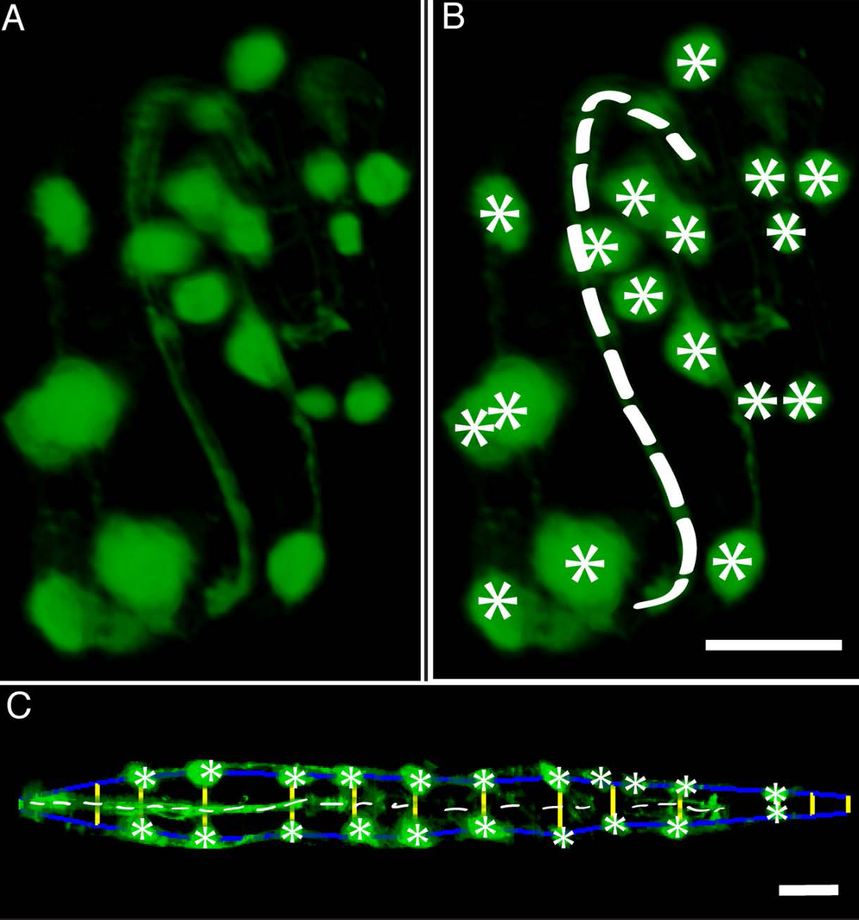 A series of three images. A fluorescently label a twisted embryo, the embryo marked by the computer, and the worm untwisted.