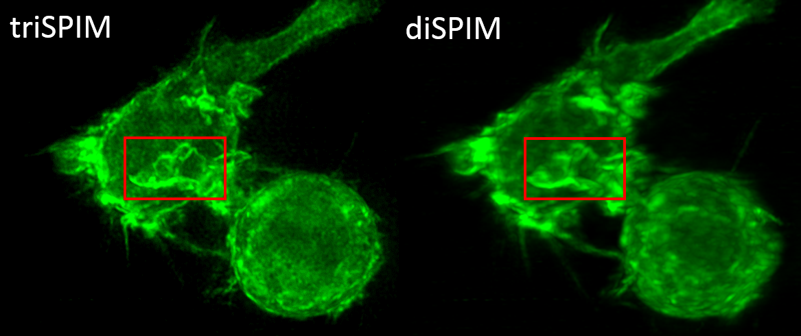 image of fluorescing immune cell using three lens microscope