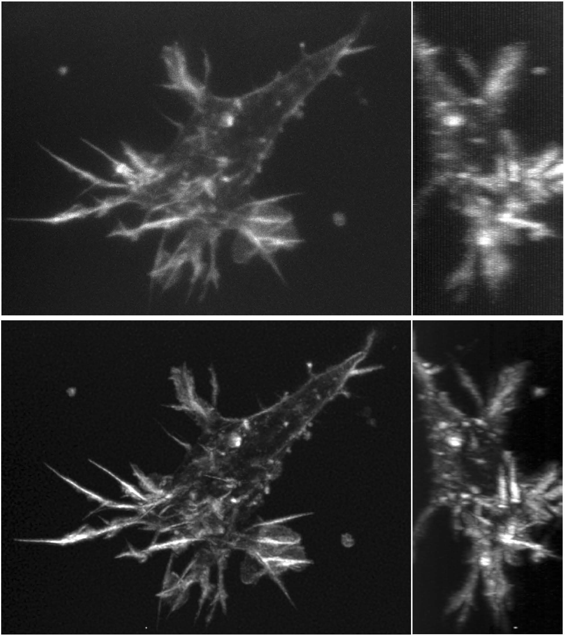 Two versions of the same mouse aorta cells, one much clearer in higher resolution than the other.