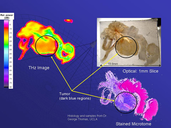 Sección de la próstata de un ratón con tejido tumoral (círculo), imagen obtenida con radiación en la banda de terahertzios, óptica y técnicas de tinción. La imagen obtenida en la banda de terahertzios muestra una reducción importante de la absorción de la radiación en la banda de terahertzios en esta región comparada con el tejido normal, lo que sugiere su utilidad para detectar tumores. Cortesia: Peter Siegel