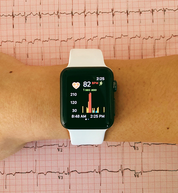 Smartwatch running app to detect atrial fibrillation