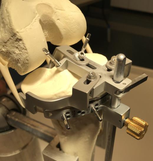 An image of the prototype being used in an knee model.