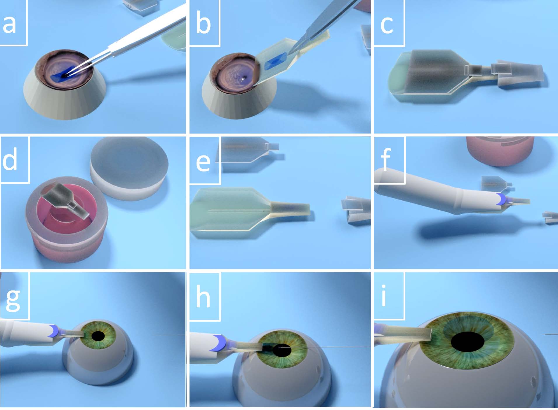 The image shows an illustration of the cornea being folded, placed in the Treyetech device, and loaded into an eye in 9 steps.