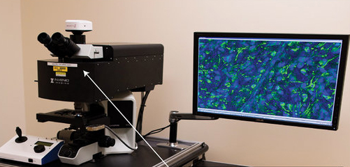 SRS microscope in the operating room