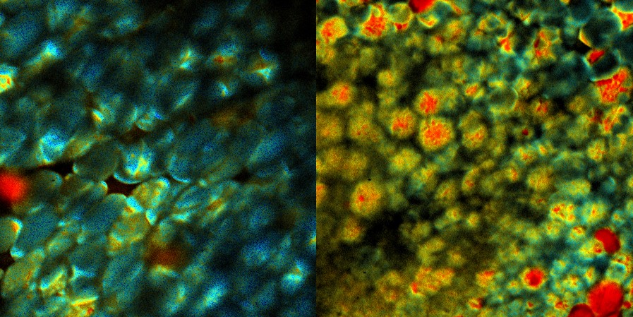 Fat cells subjected to cold temperatures Fat cells subjected to cold temperatures
