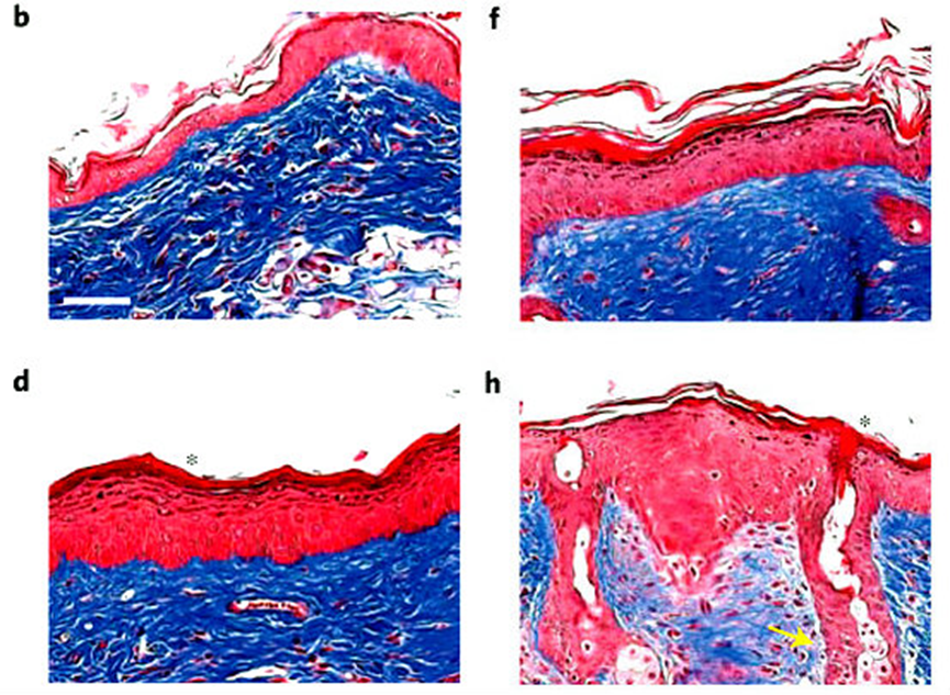 cross-sections show similar UV protection from sunscreen alone and encapsulated in BNPs