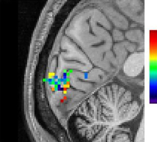 fMRI of brain visual cortex fMRI of brain visual cortex