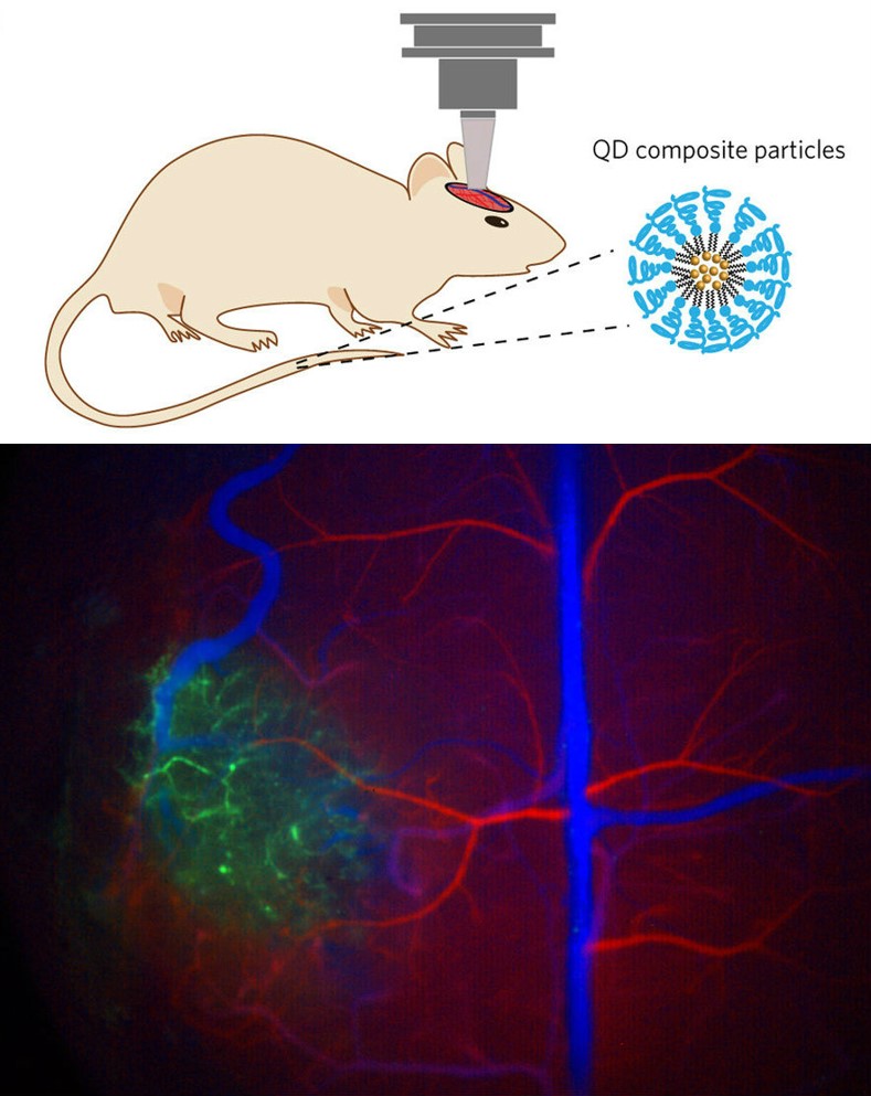 Quantum dot imaging of mouse brain tumor Quantum dot imaging of mouse brain tumor