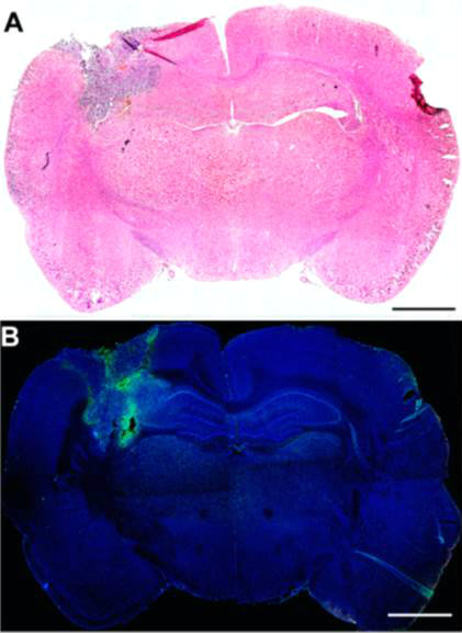 Brain slice showing efficient delivery of nanoparticles