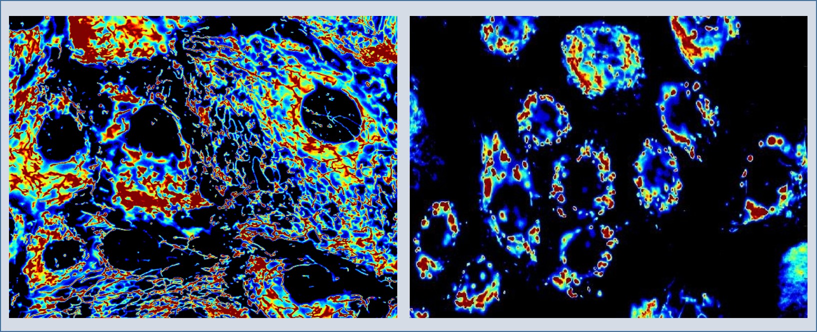 Difference in mitochondrial cell distribution in normal versus cancer cells Difference in mitochondrial cell distribution in normal versus cancer cells
