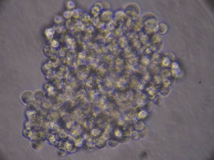 CTCs expanded as spheres of growing cells in the laboratory