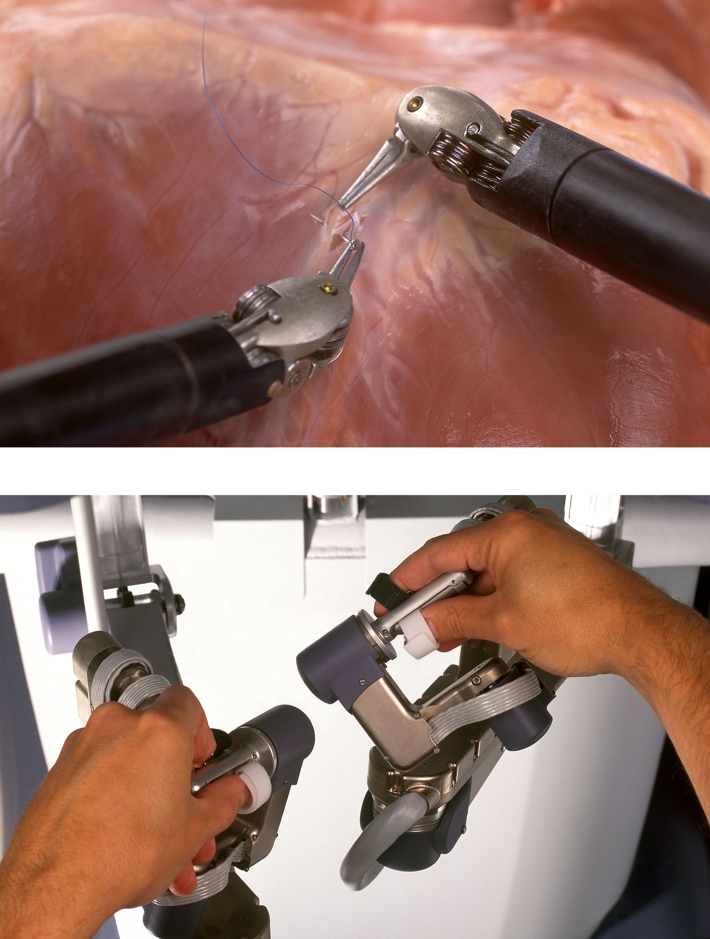 Los sistemas de cirugía robótica pueden mejorar los resultados del paciente, pero los cirujanos no pueden sentir las suturas o tejidos involucrados. Investigadores de la Universidad Johns Hopkins están desarrollando retroalimentación visual y sensores de fuerza para crear un sistema de cirugía asistida-por-robot que permita a los cirujanos mejor sensación de las fuerzas que ocurren en el campo de operación. ©2006 Intuitive Surgical, Inc.