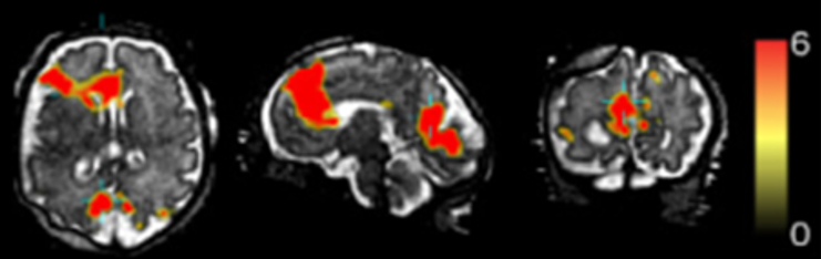 Scientists discover how our brains track where we and others go