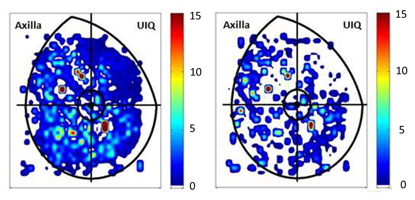Title Text color graph on breast diagrams with left showing adequate pressure and right showing inadequate pressure.