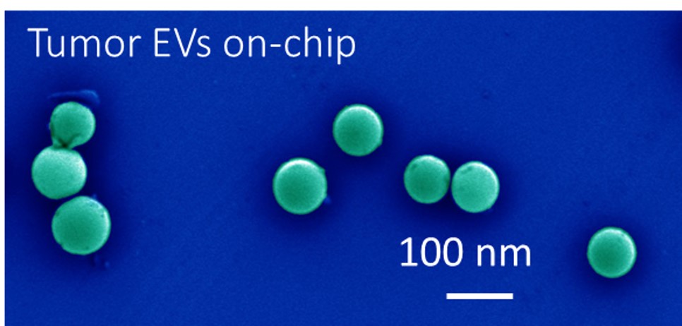 tumor EVs on chip tumor EVs on chip