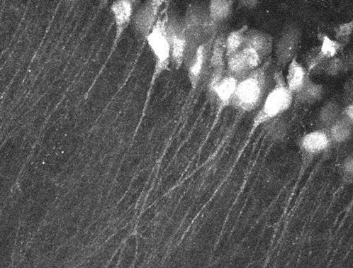 beta actin fluorescing in neurons
