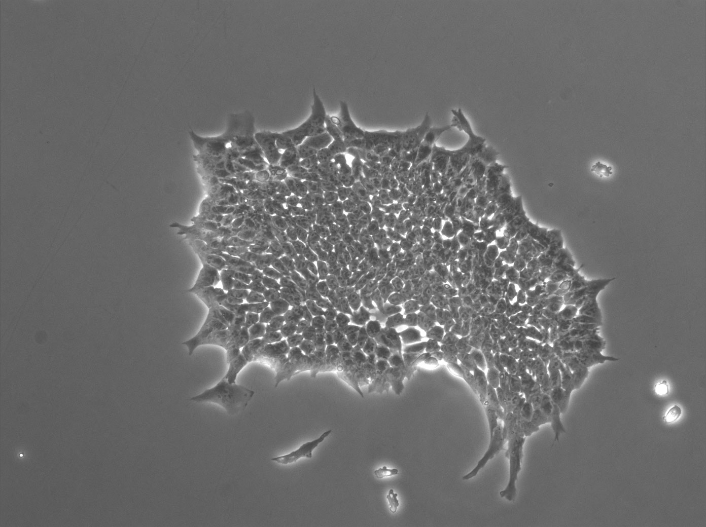 Phase contrast image of a colony consisting of mouse embryonic stem cells stably expressing Ronin. Imagen de contraste de fase de una colonia formada por células madre embrionarias de ratón que expresan a Ronin de forma estable. La colonia se formó a pesar de ser expuesta a un medio de cultivo de un tejido que normalmente hubiera causado diferenciación.