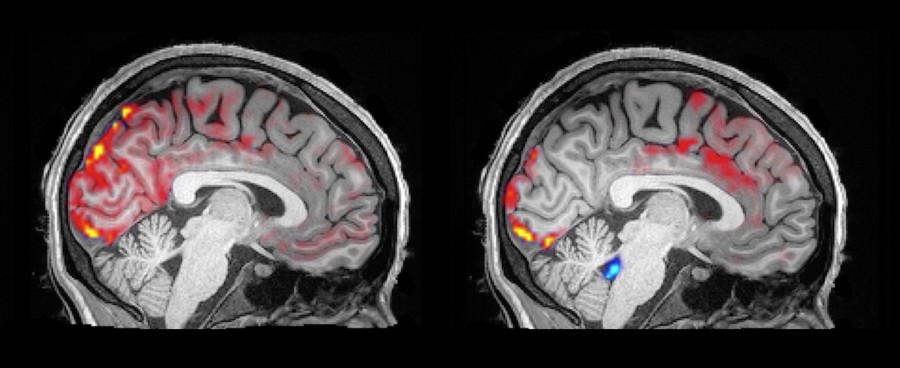 fMRI of blood CSF exchange during sleep