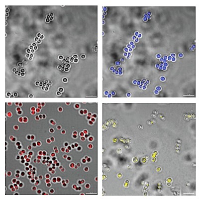 Microscopic image of 3 different dyes (blue, yellow, and red) and the control.