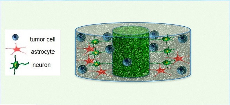 diagram of silk culture system with human tumor cells