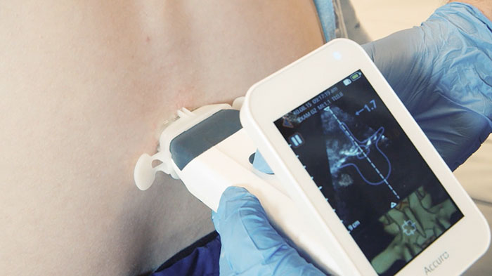 Hand-held ultrasound device