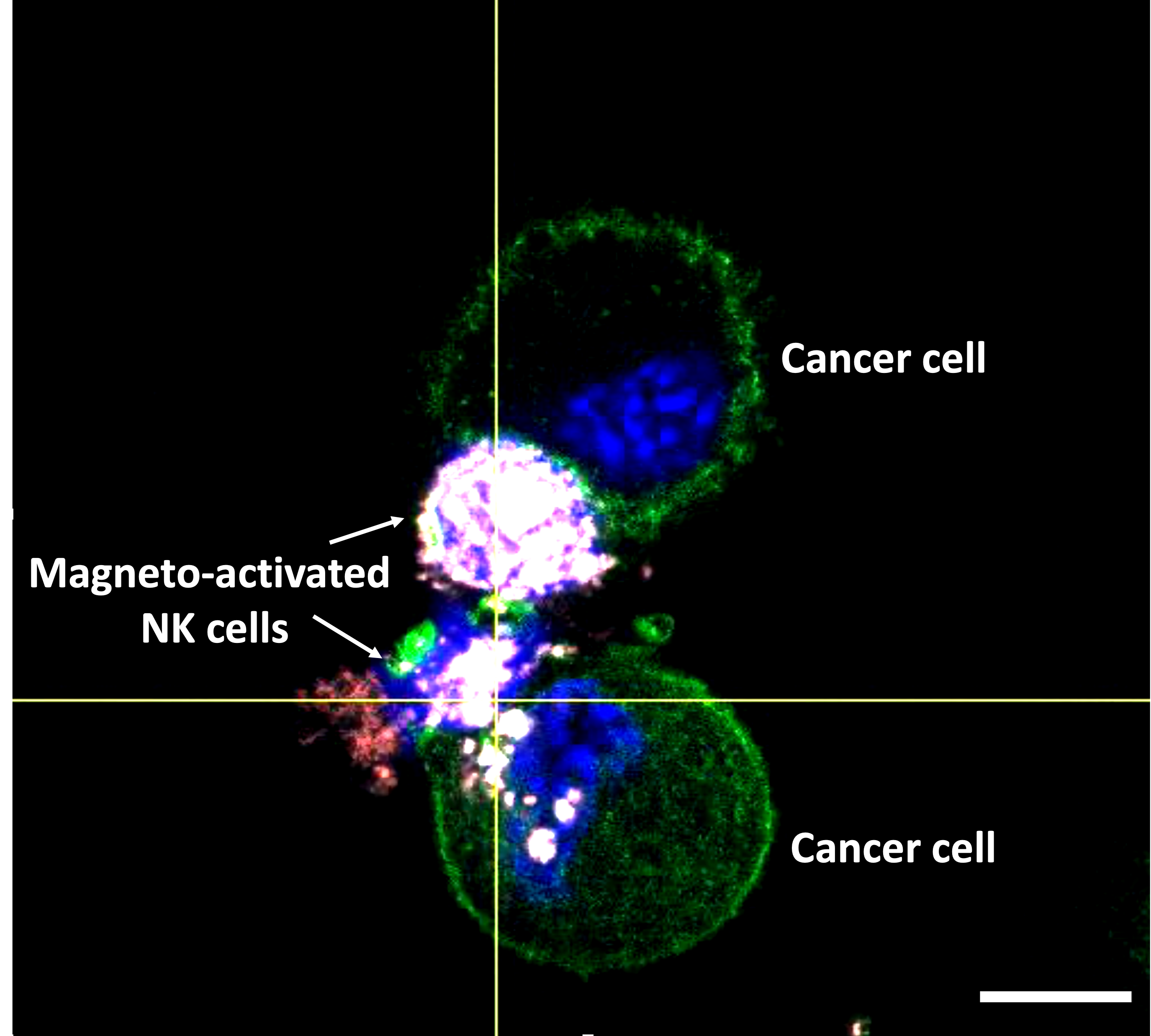 Confocal microscopy image showing modified natural killer cells attacking cancer cells