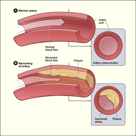 drawing of blood vessels